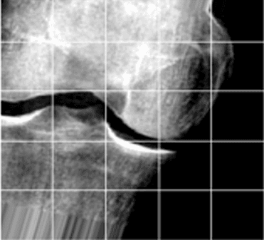 A Transfer Learning Approach for Classification of Knee Osteoarthritis paper